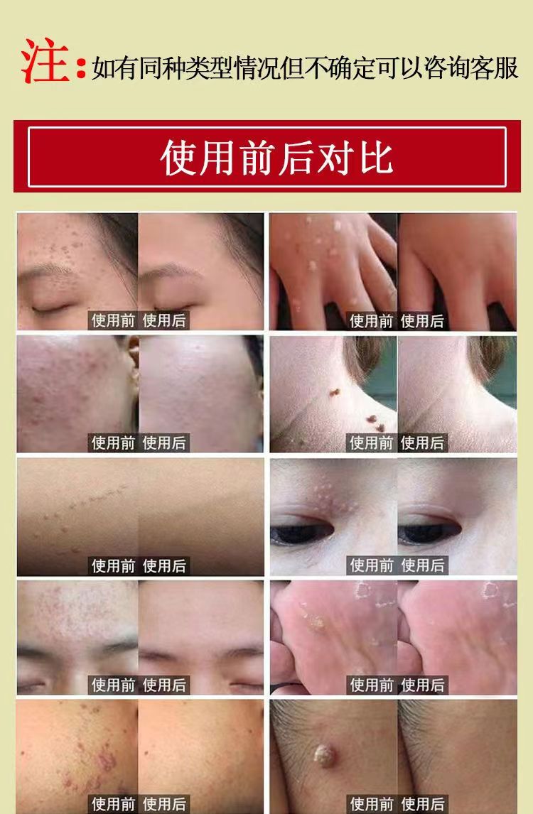 Brucea Javanica Oil | Macassar Kernels | Java Brucea | Ya Dan Zi You-Pure Chinese Herb™